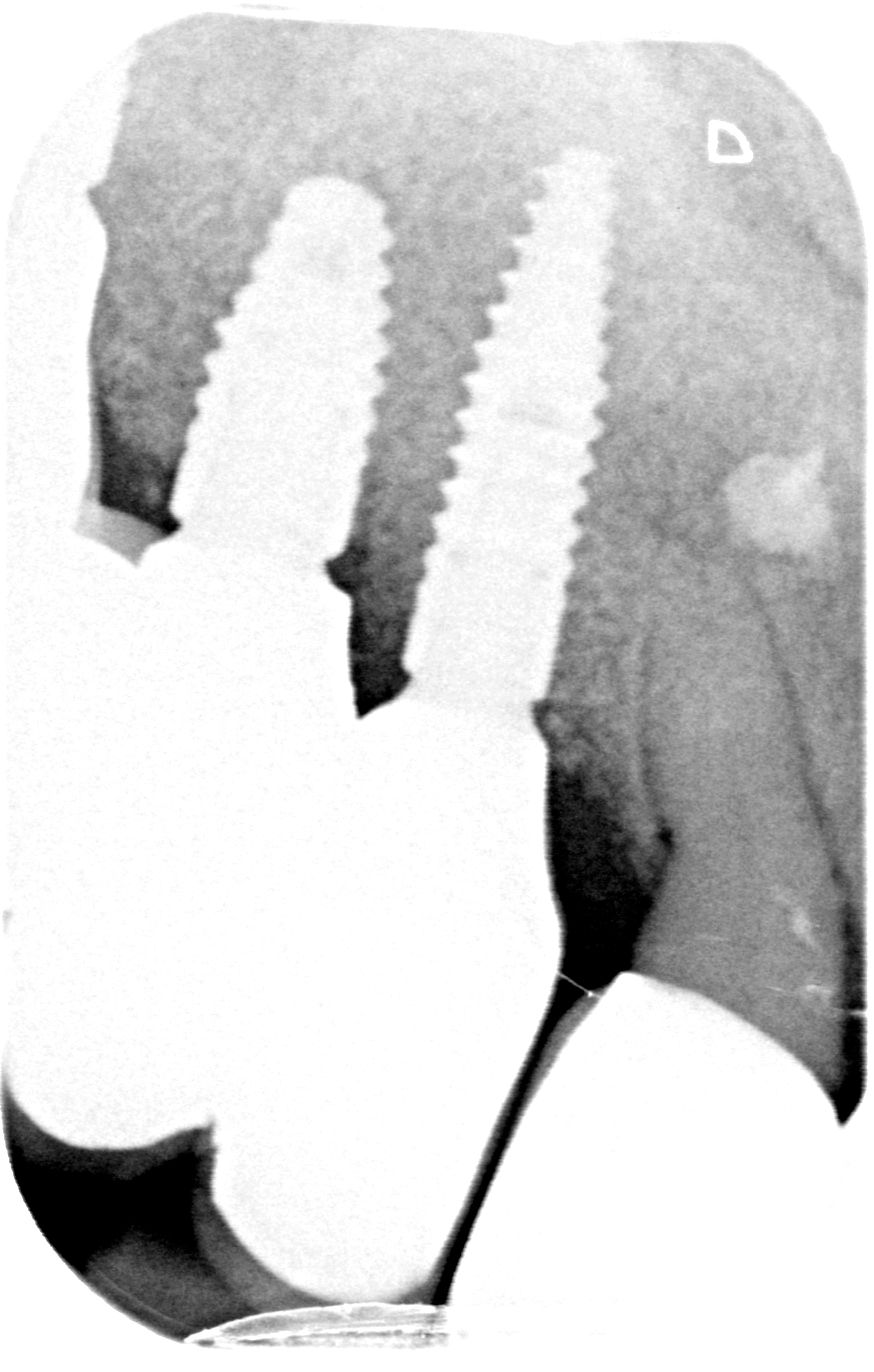 fig. 21