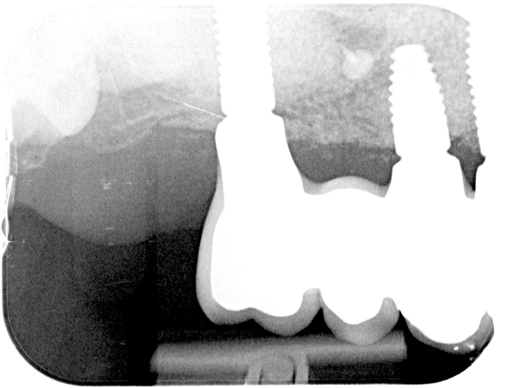 fig. 22
