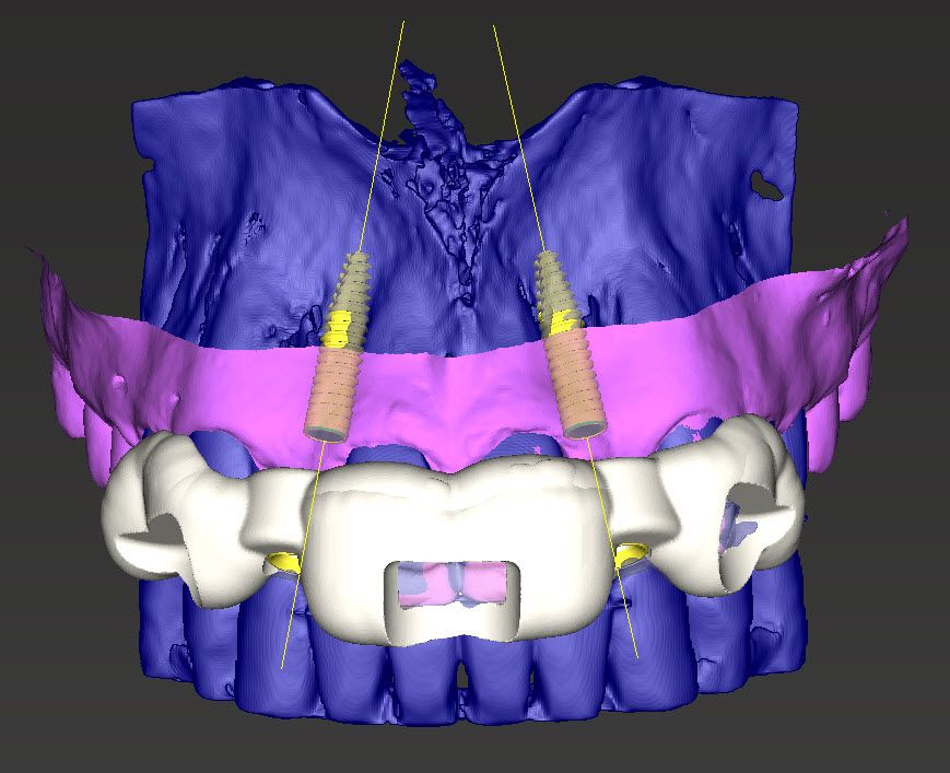 fig. 7