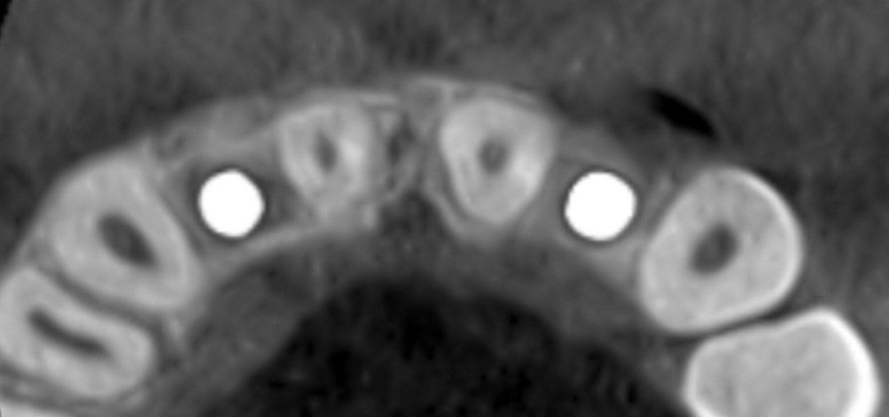 fig. 18