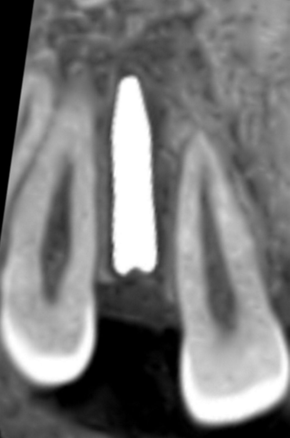 fig. 19