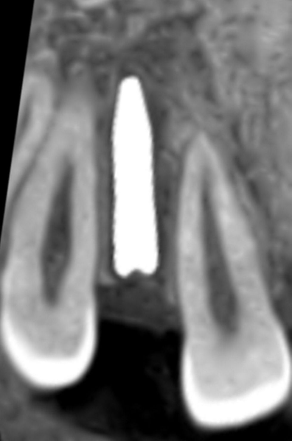 fig. 19