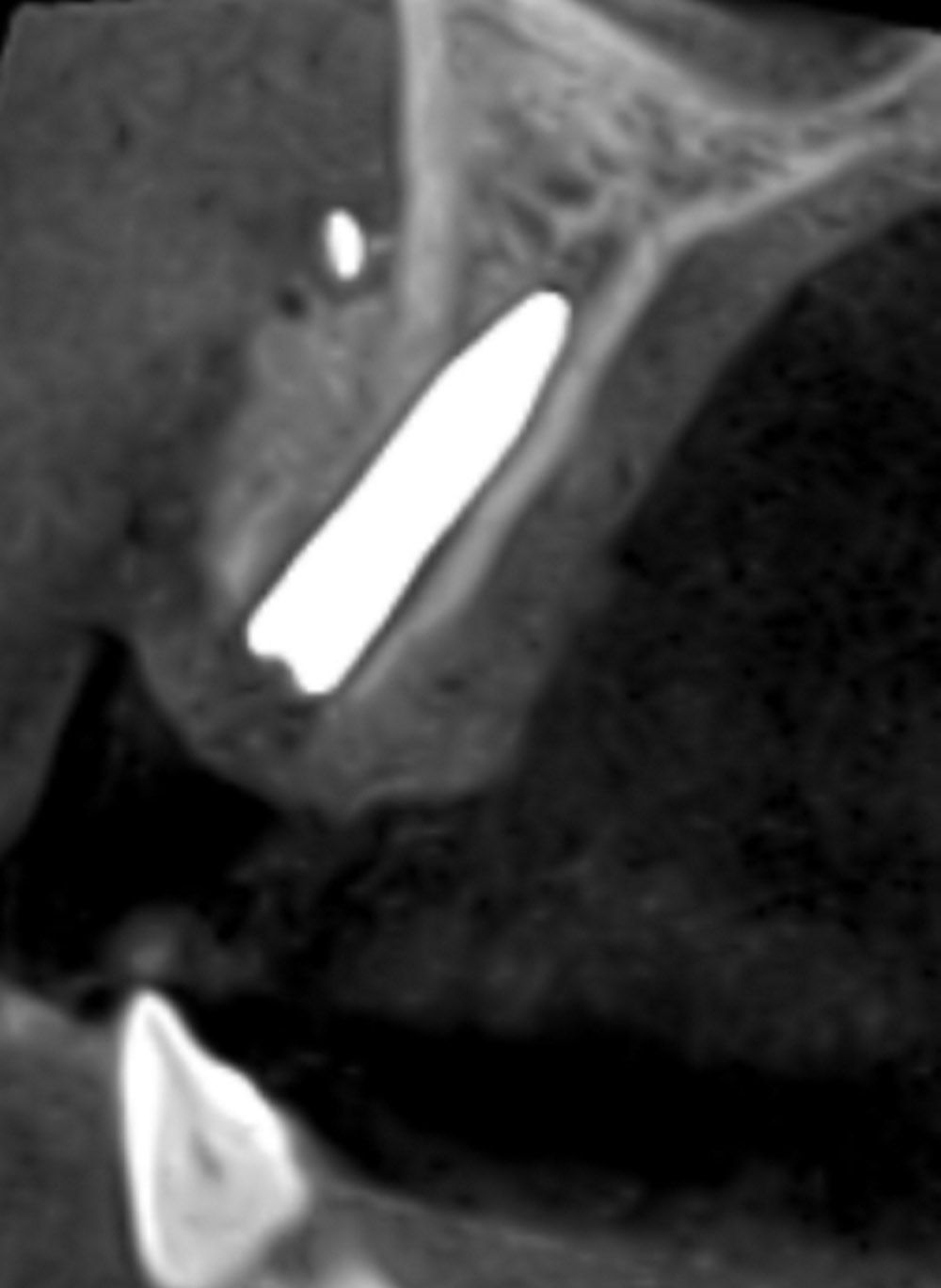 fig. 20