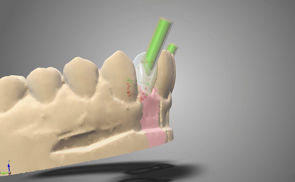 fig. 26