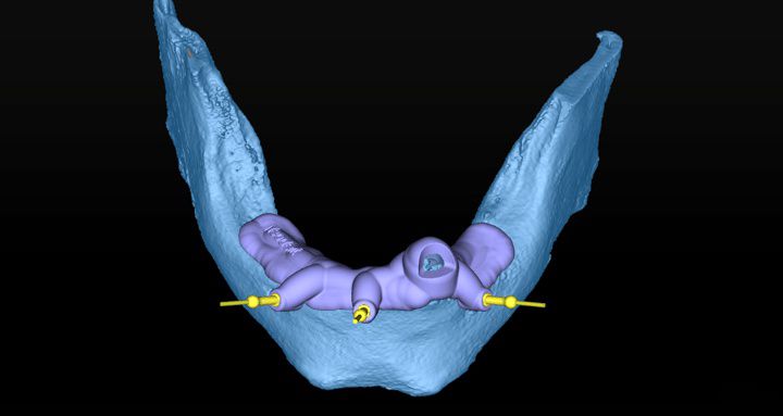 fig. 10