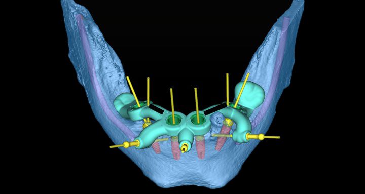 fig. 12
