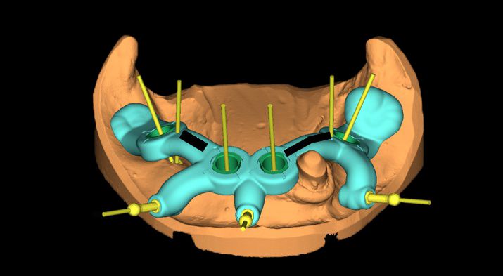 fig. 13