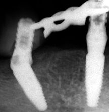 Fig. 22a