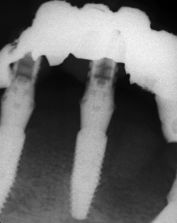 fig. 22b