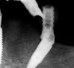 fig. 22c