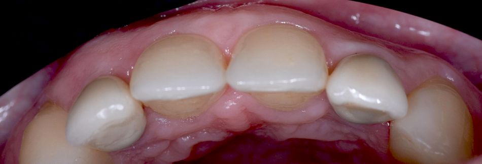 fig. 32