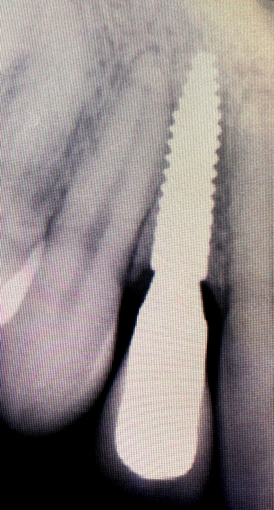 fig. 33