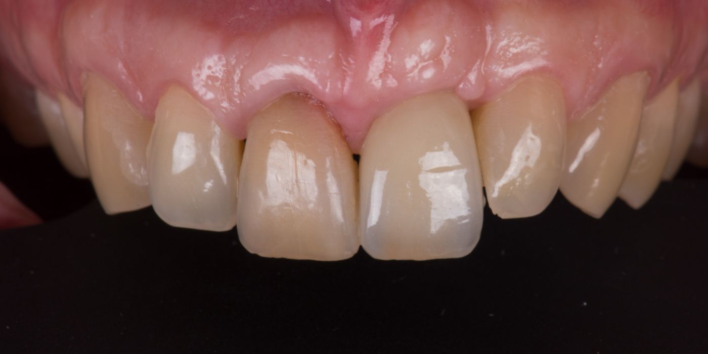 fig. 1a
