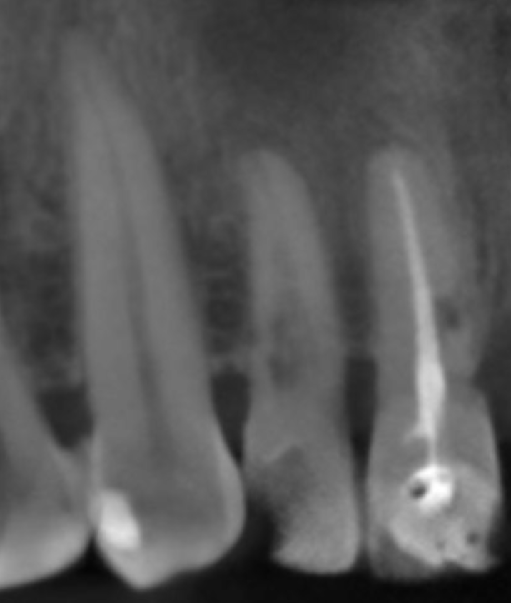 fig. 1b