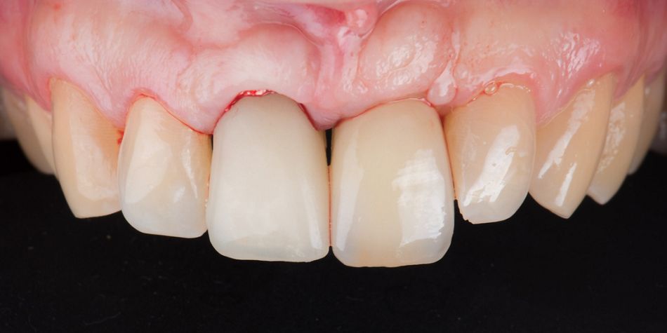 fig. 14