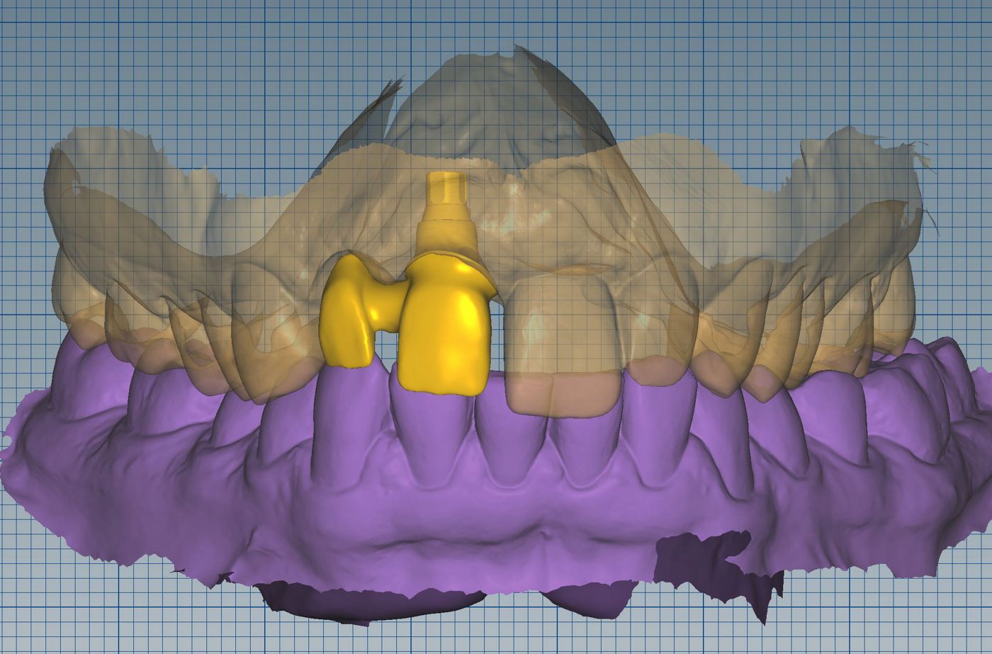 fig. 19