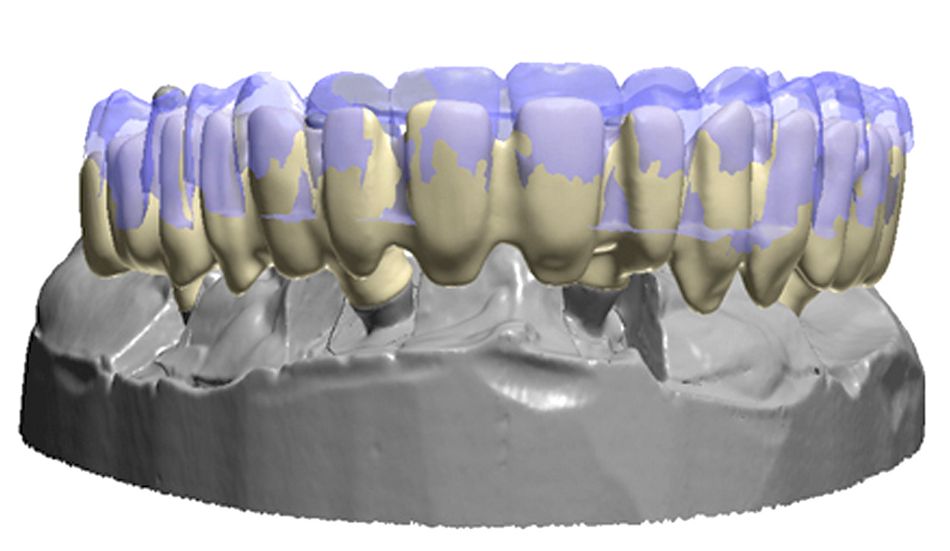 fig. 16