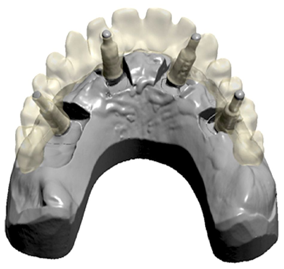fig. 17