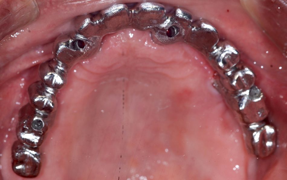 fig. 18