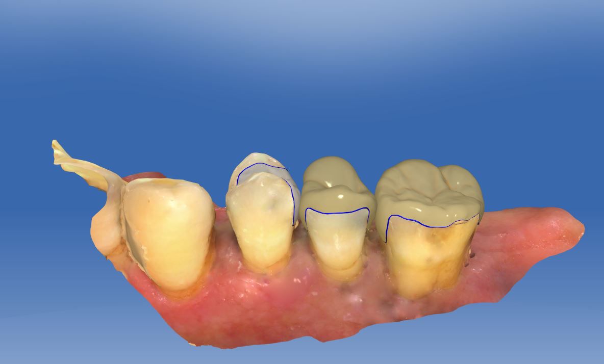 Fig. 7a Exemplary presentation of the CAD construction…