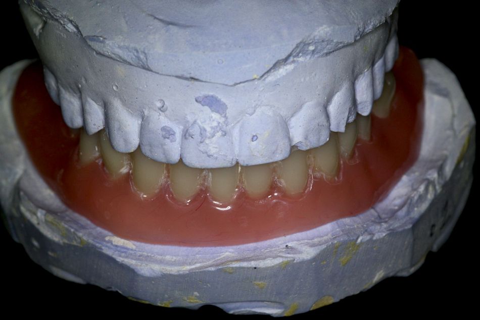 fig. 11
