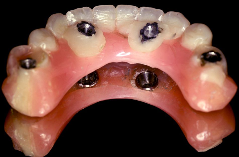 fig. 29