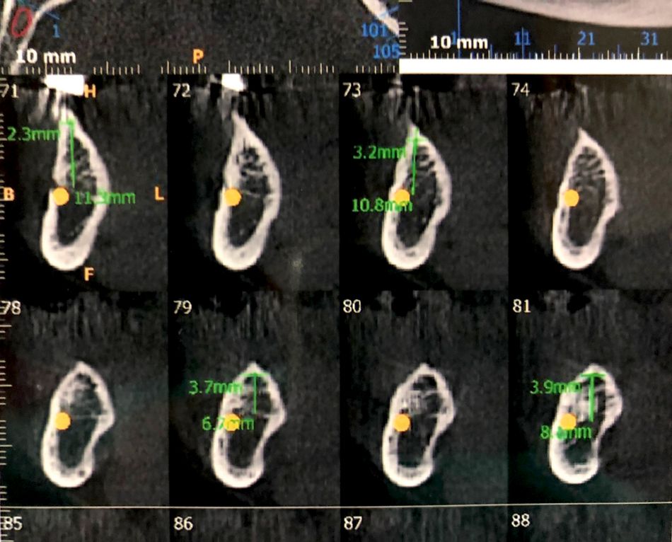 fig. c