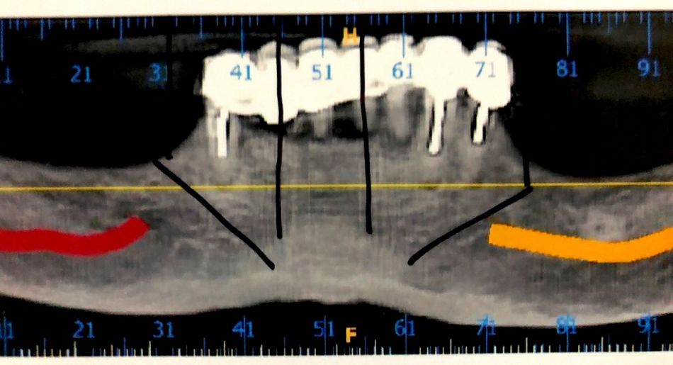 fig. e