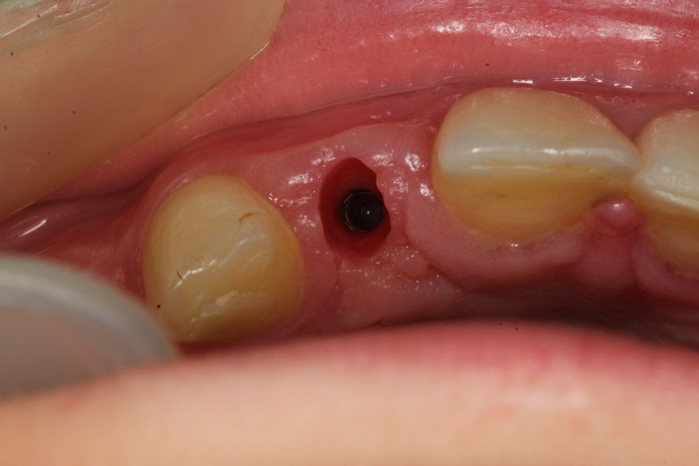 fig. 28b