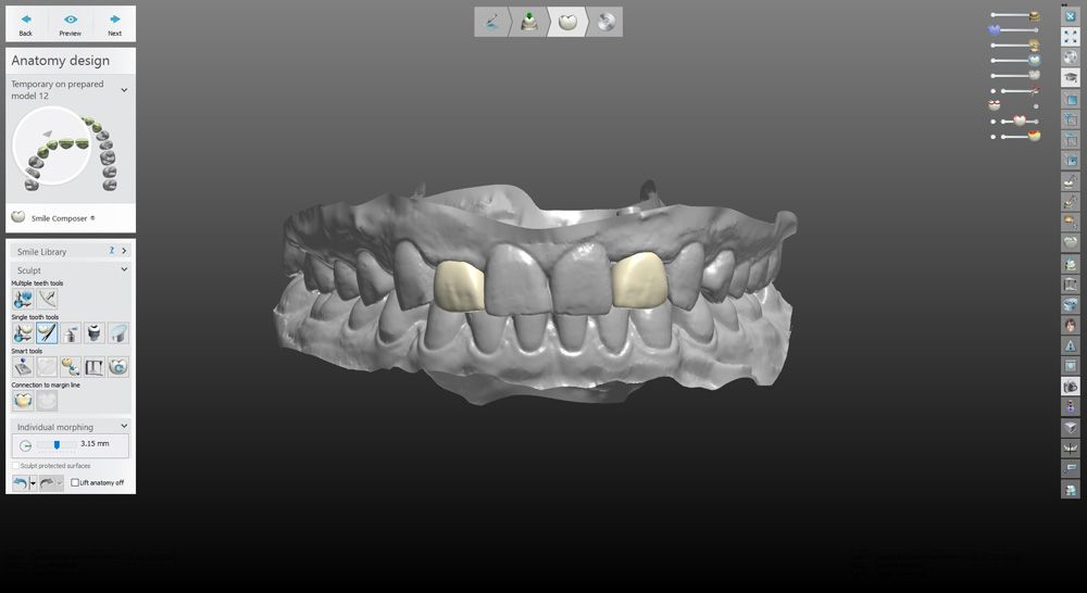 fig. 31