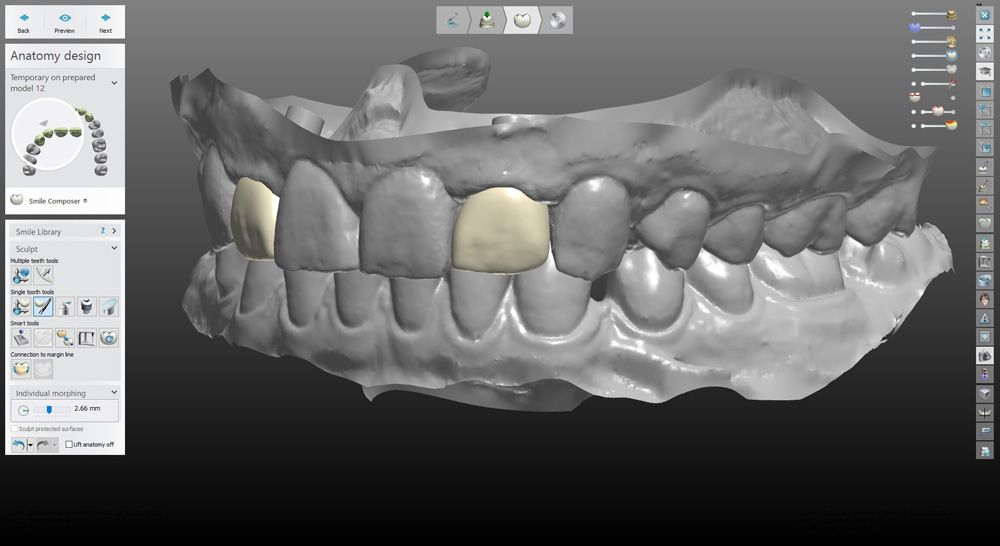 fig. 33