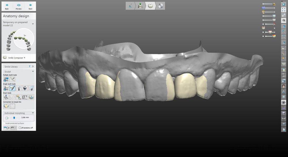 fig. 35