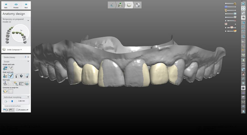 fig. 35