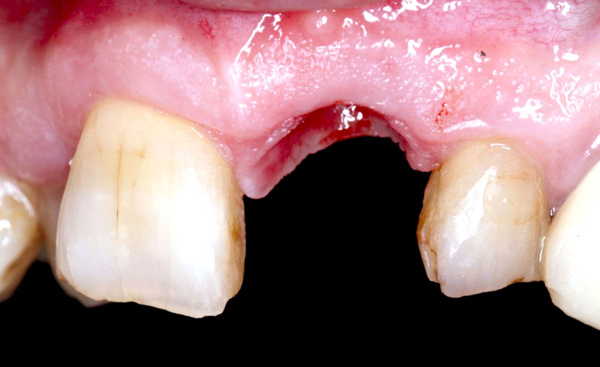 fig. 25