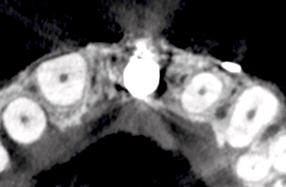 fig. 29