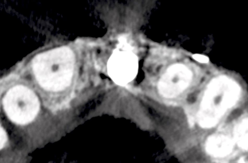 fig. 29