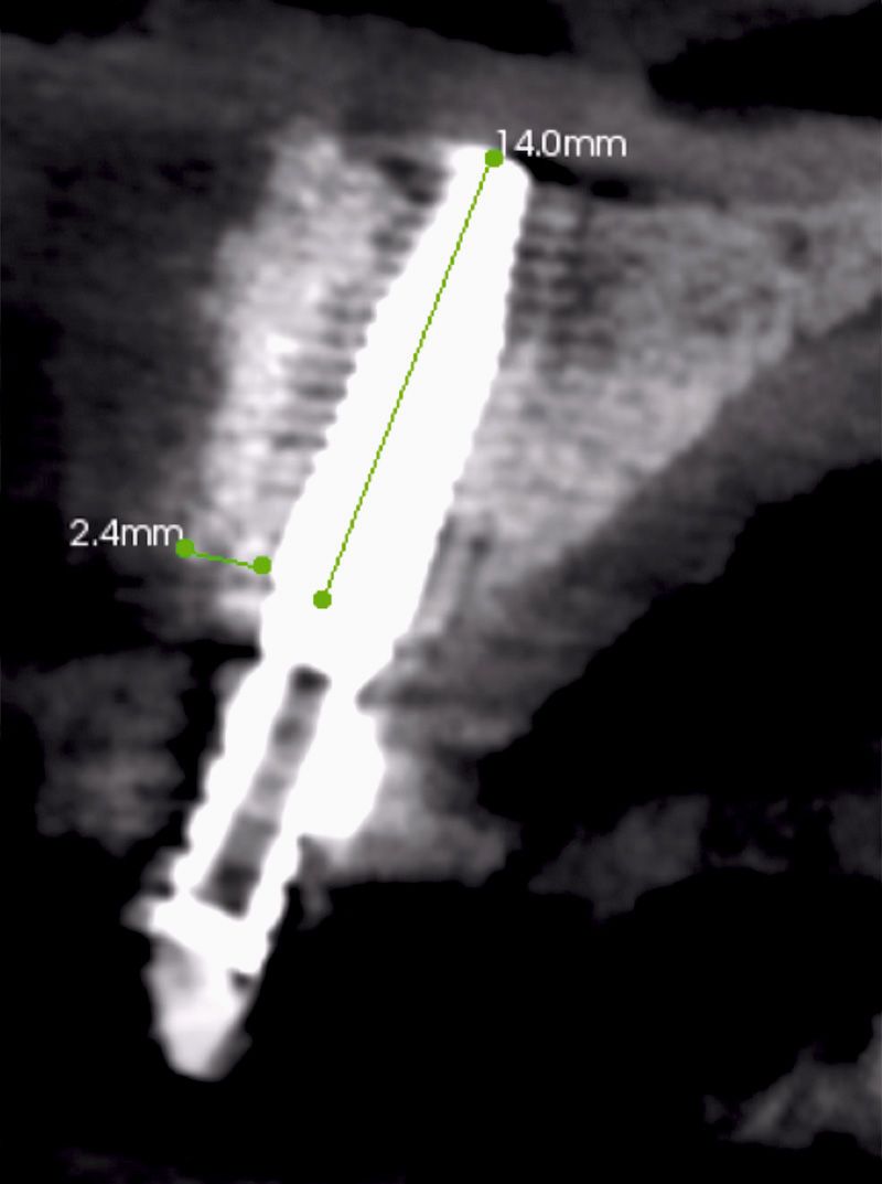 fig. 30