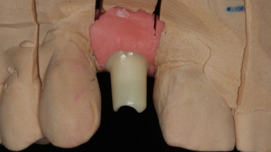 fig. 13