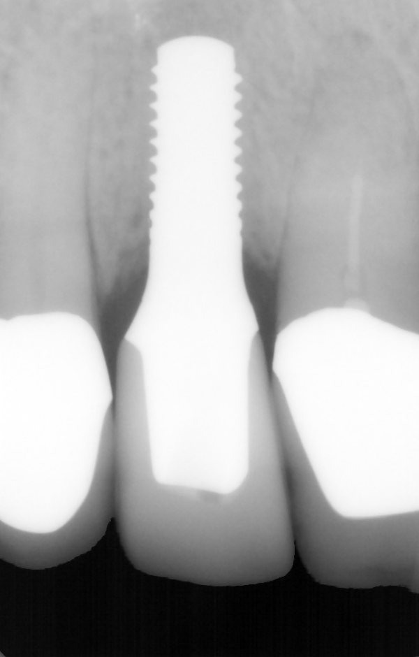 fig. 15