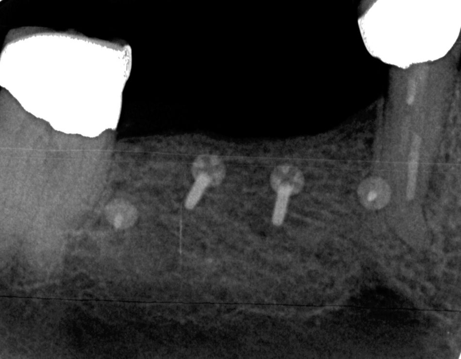 fig. 10