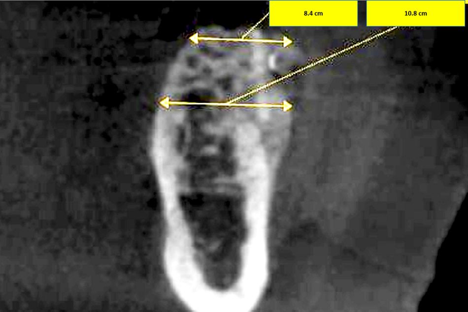 fig. 12