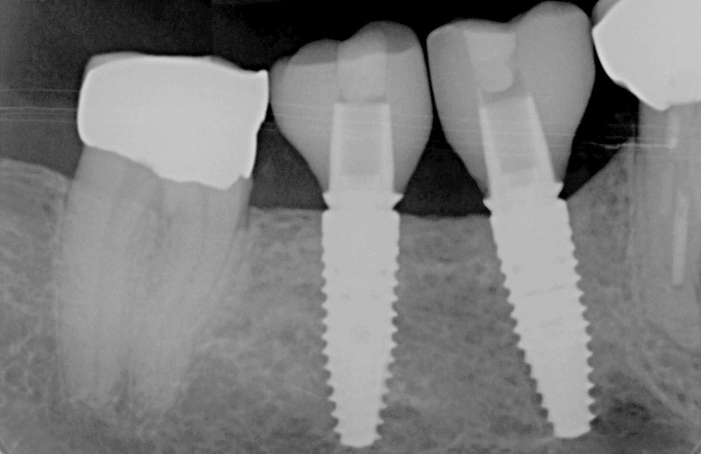 fig. 30