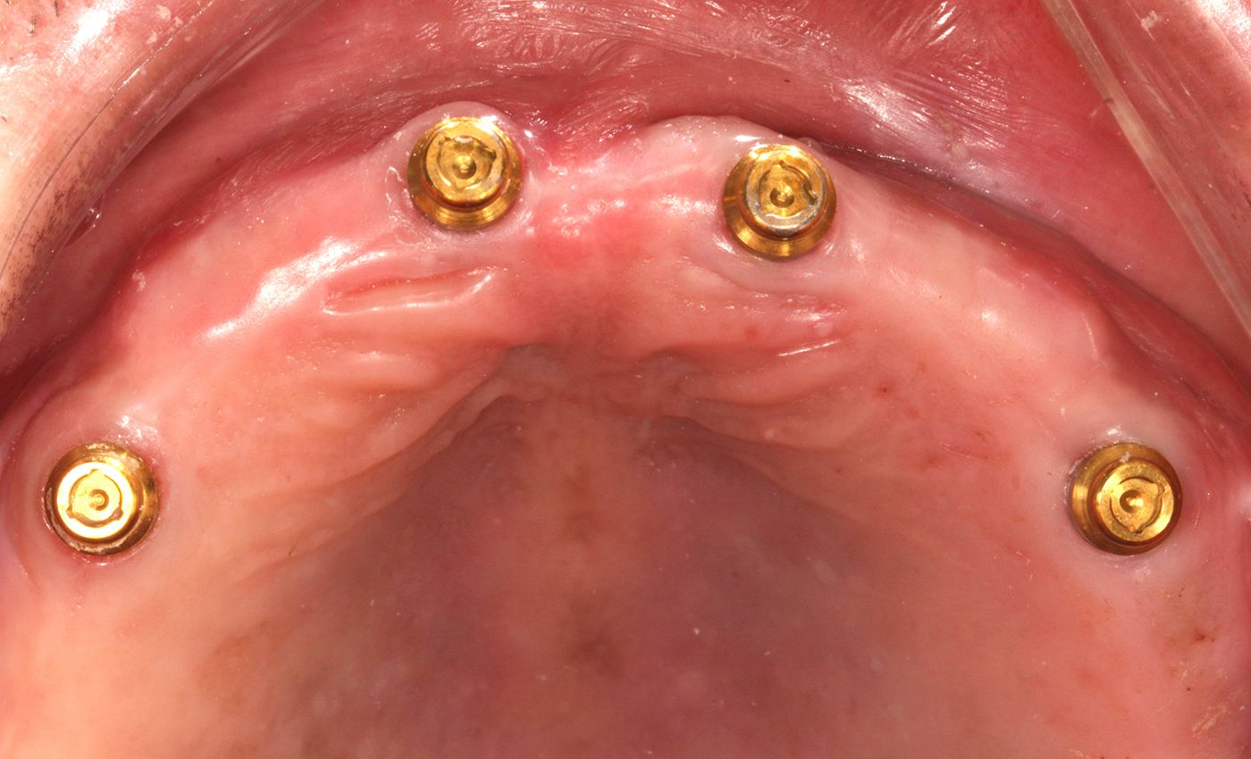 fig. 7