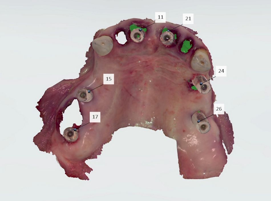 fig. 12