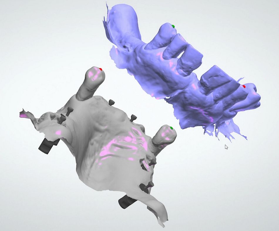 fig. 15