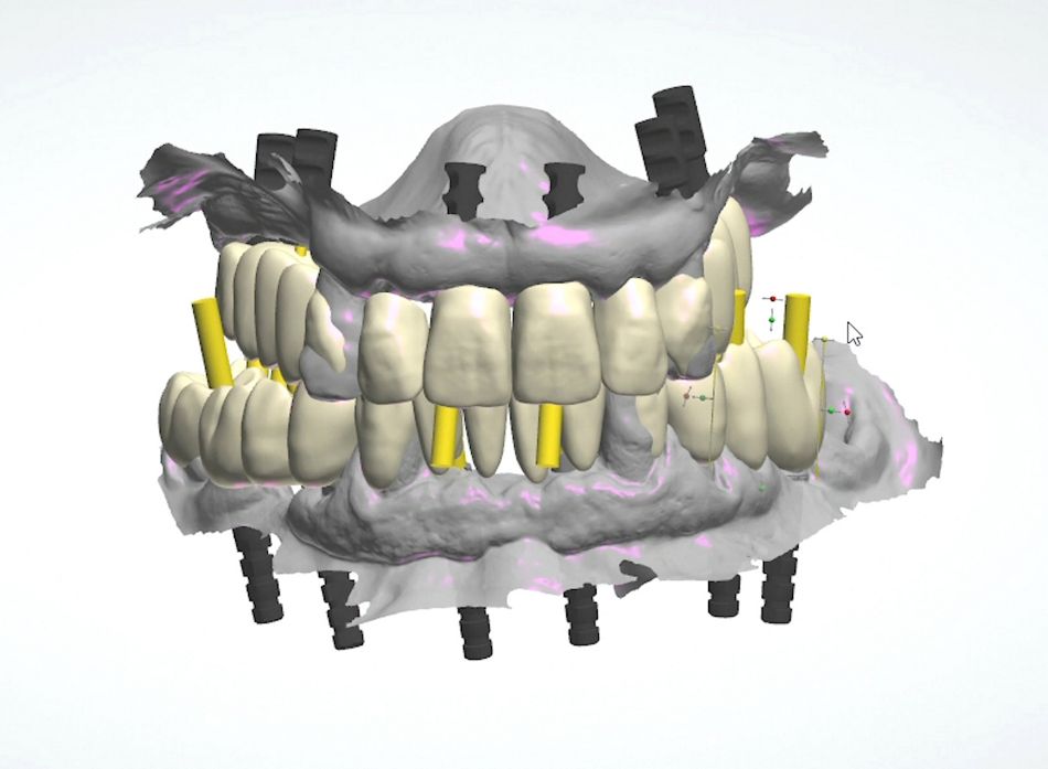 fig. 17