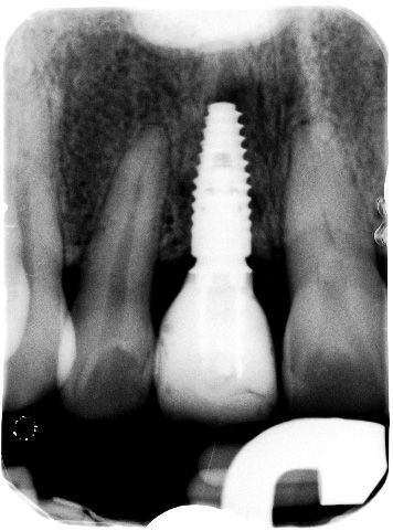 fig. 9