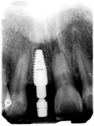 fig. 10