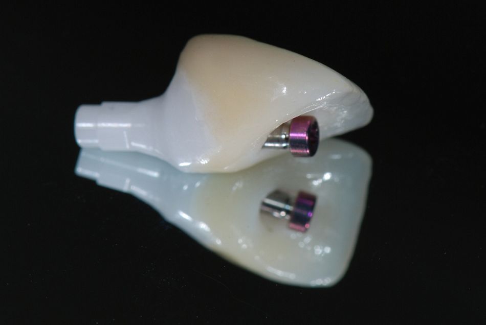 fig. 13