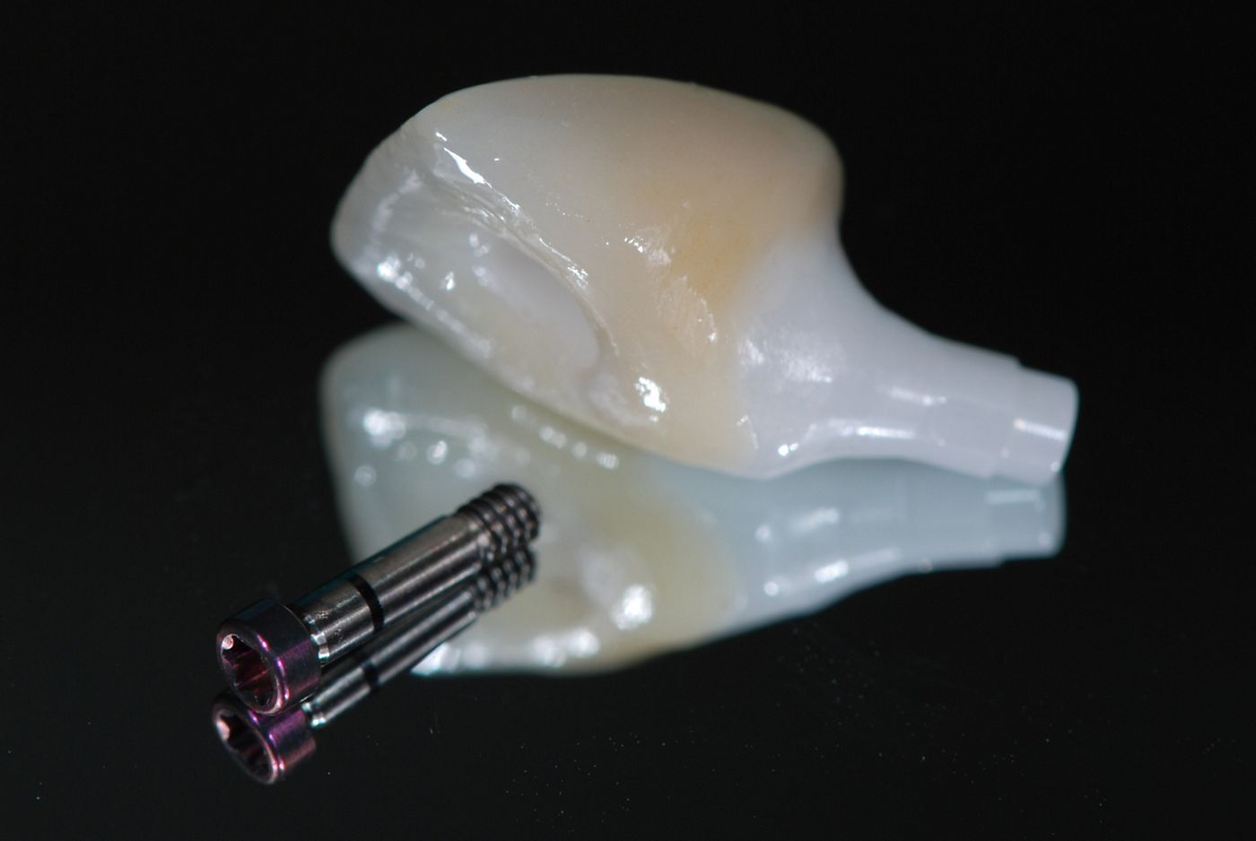 fig. 14